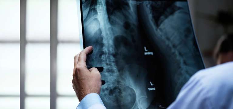 Demystifying X-ray Services: Cost, Convenience, and Finding the Best Option in Delhi